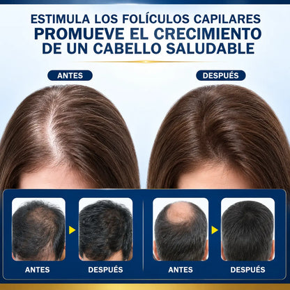 Compre 1 Llévate 2 – Crema Para Crecimiento Capilar ProHair™